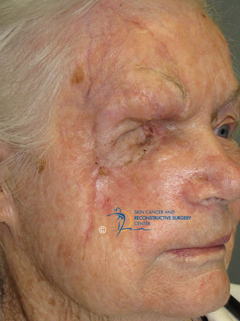 skin deep therapy skin deep therapy