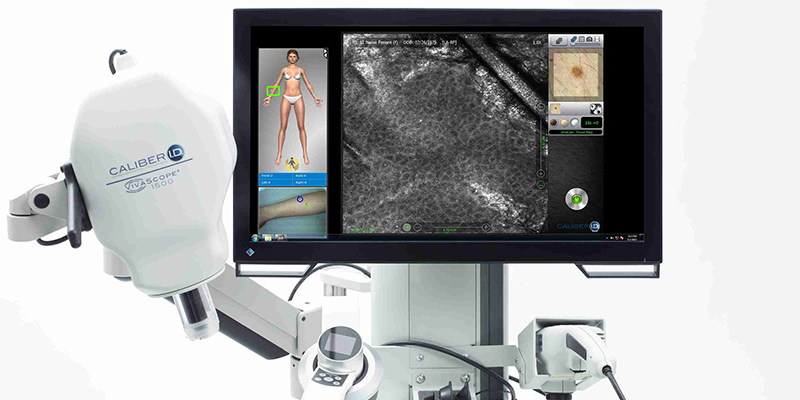 Skin-Cancer-Specialists-Skin-Cancer-Diagnosis-Techniques-Reflectance-Confocal-Microscopy-Skin-Cancer-and-Reconstructive-Surgery-Center-Orange-County